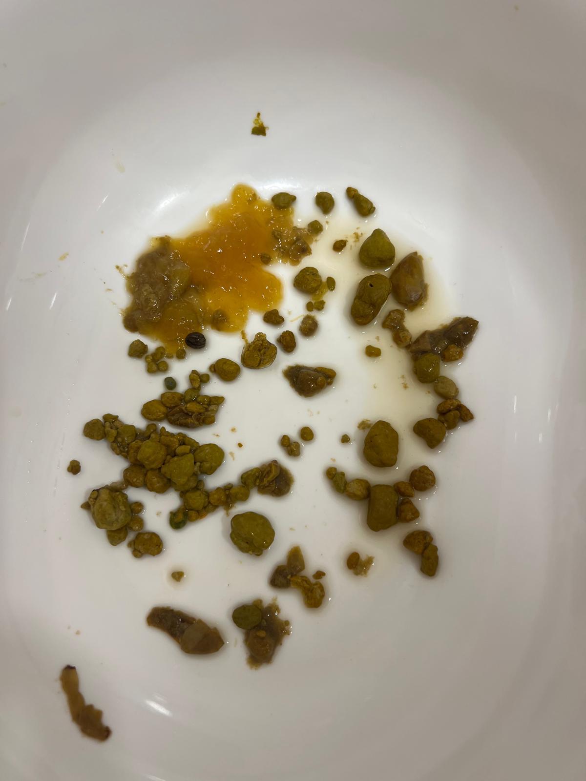 Ausscheidung — Entgiftungsphase